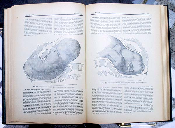 Малая энциклопедия практической медицины В шести томах Том 1 Серия: Малая энциклопедия практической медицины В шести томах инфо 6024g.